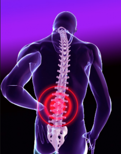 Stem Cells for back pain